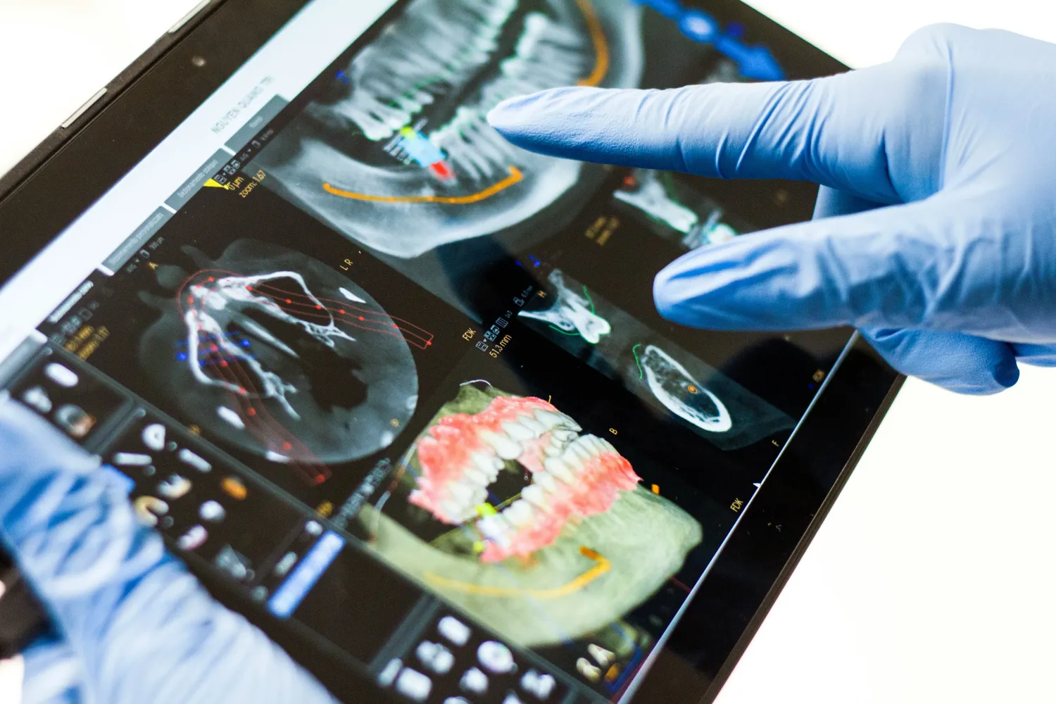 Dental implants consultation New York — dental practice marketing